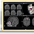 viewing software / diagnostic / medical / operating theatre - Buzz™
