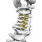 Vertebra Laminoplasty Plate Double Medical Technology Cervical