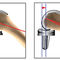 Three Compartment Knee Prosthesis Dknee Enovis Surgical Fixed