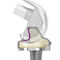 Three Compartment Knee Prosthesis Attune Depuy Synthes Revision