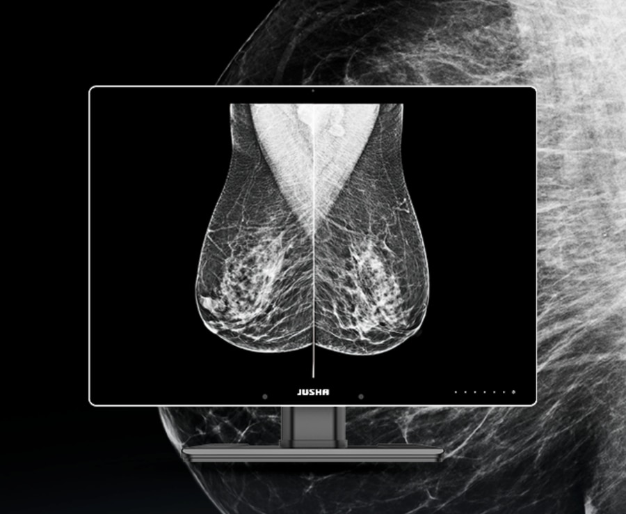 Jusha Launched A New 12MP Medical Image Intelligent Display Terminal