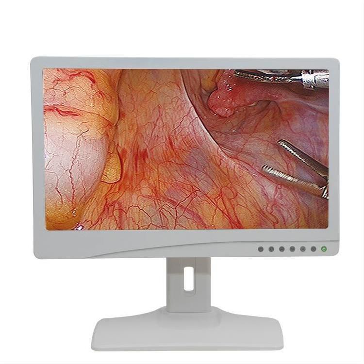 Monitor Para Endoscopia Chengdu Mechan Electronic Technology