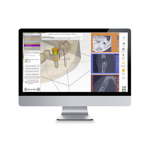 Software médico hospitalar CAD Software Zfx GmbH de laboratório