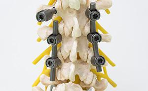 Spine Surgery All Medical Device Manufacturers In This Category