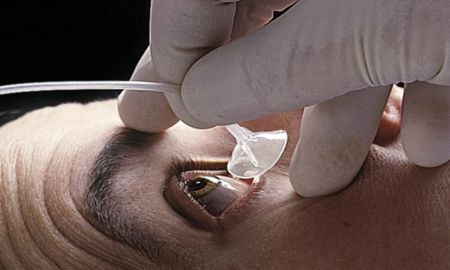 Morgan Lens: Revolutionizing Ocular Emergency Care in France