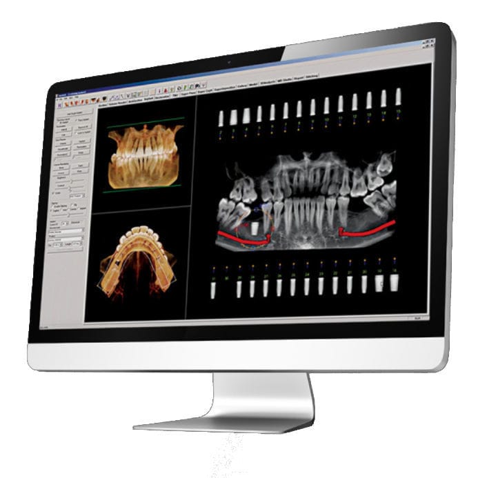 Dental software Invivo™ 6 DEXIS for dental imaging / for control