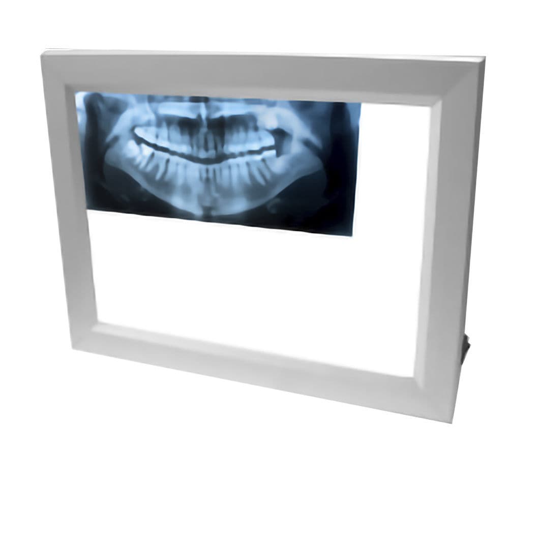 1screen Xray film viewer XLDS08W ECLAIRE SRL 2screen / 3