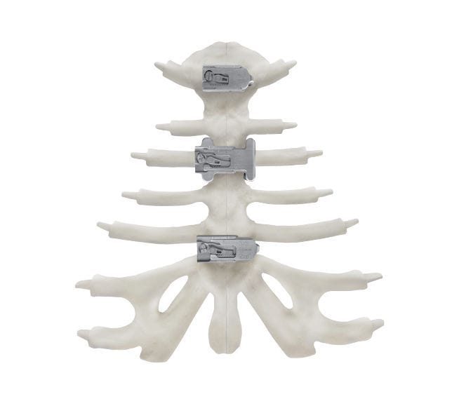 Sternum compression plate KT series Kontour Medical Technology