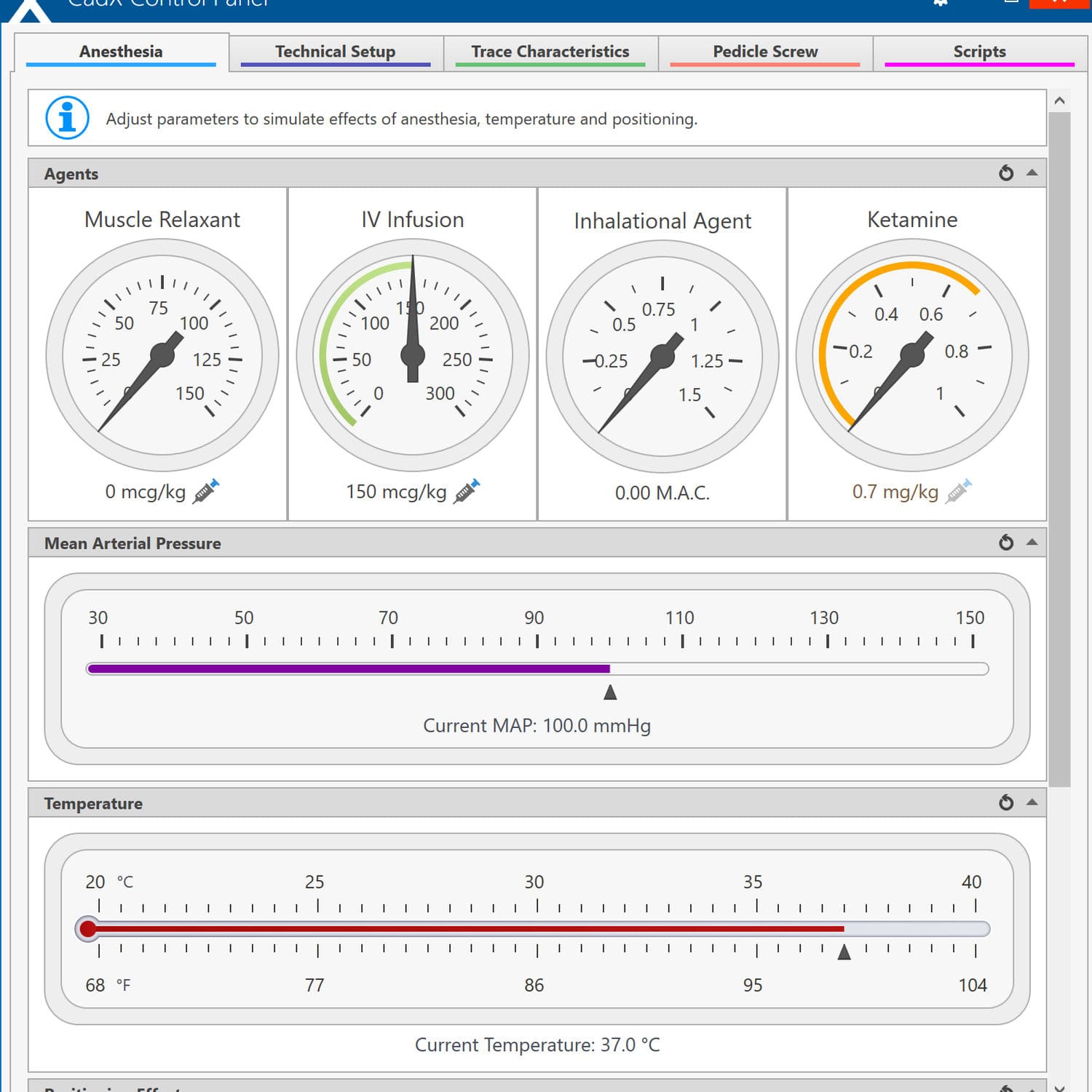 EEG software CADX Cadwell Industries EMG / anesthesia / surgical
