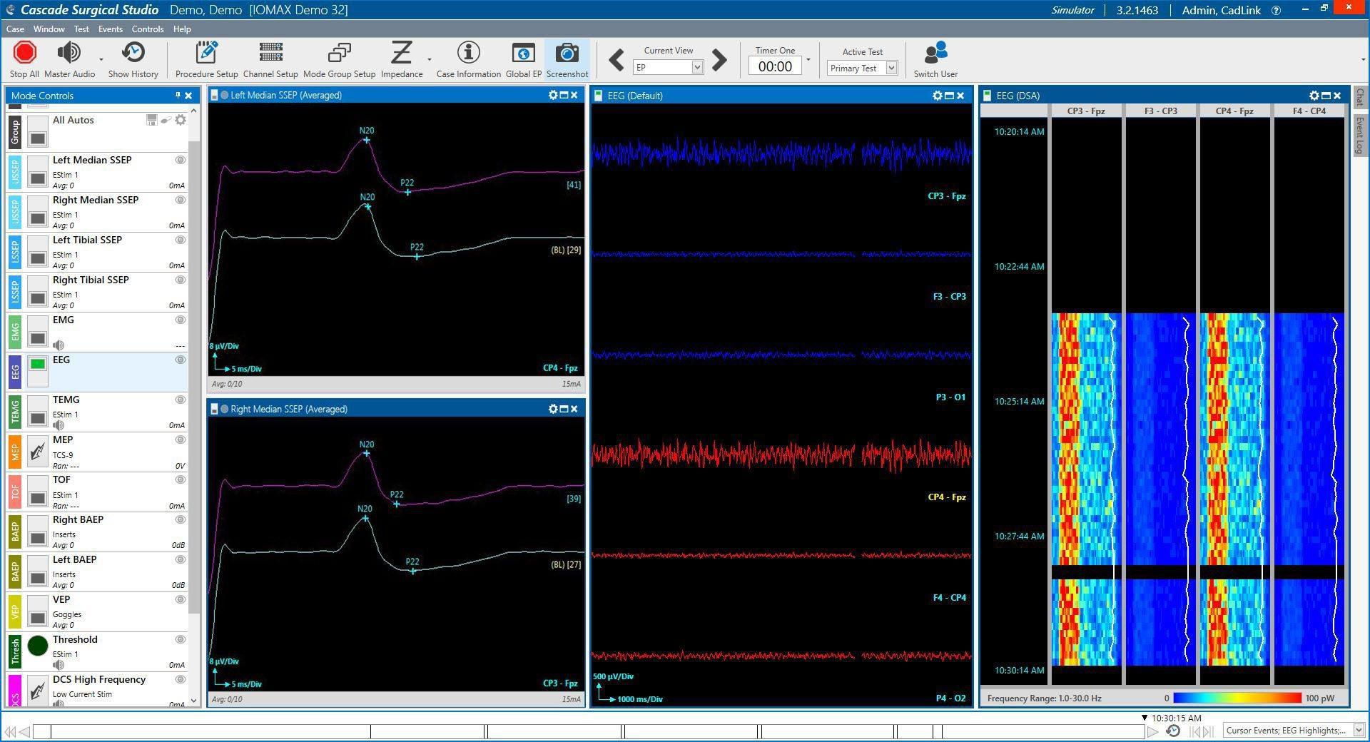 Clinical software Cascade® Cadwell Industries EEG / EMG / surgical