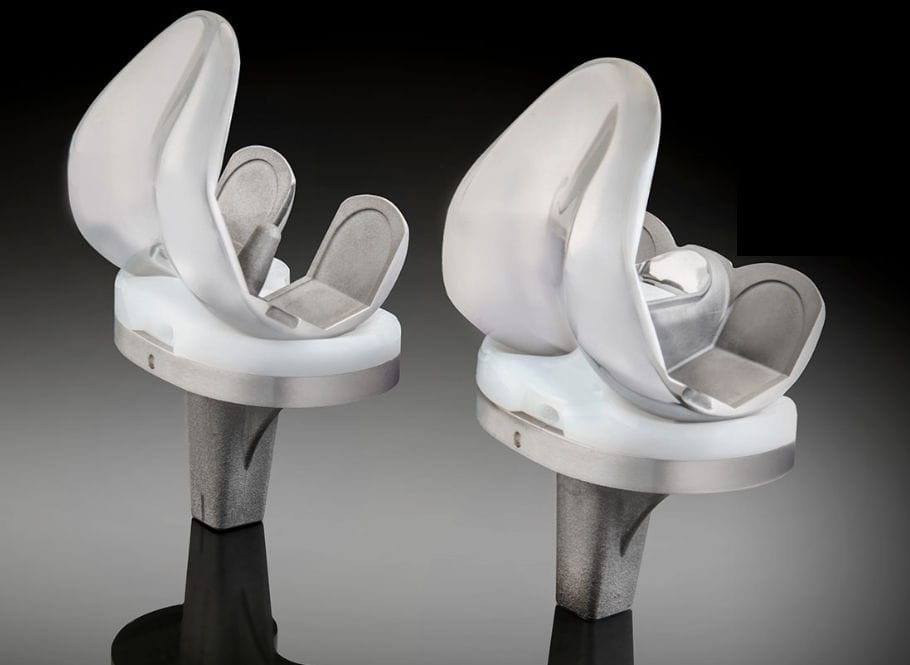 knee prosthesis Truliant® Exactech revision