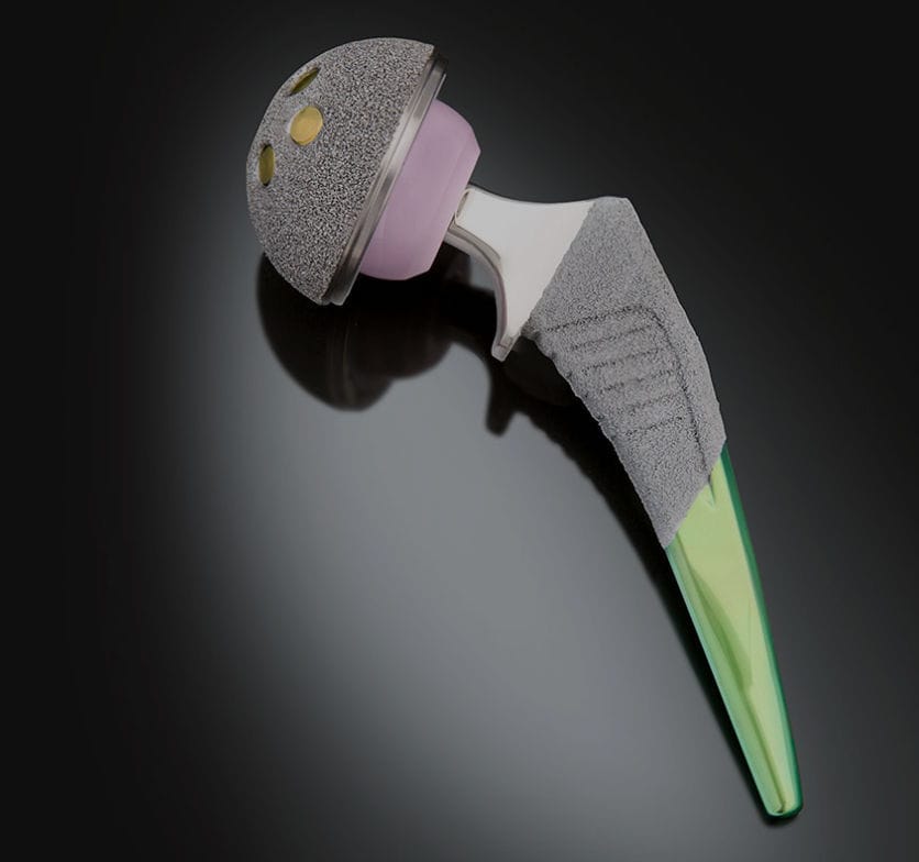 Minimally Invasive Hip Prosthesis Spartan Exactech Cementless minimally-invasive-hip-prosthesis-spartan-exactech-cementless
