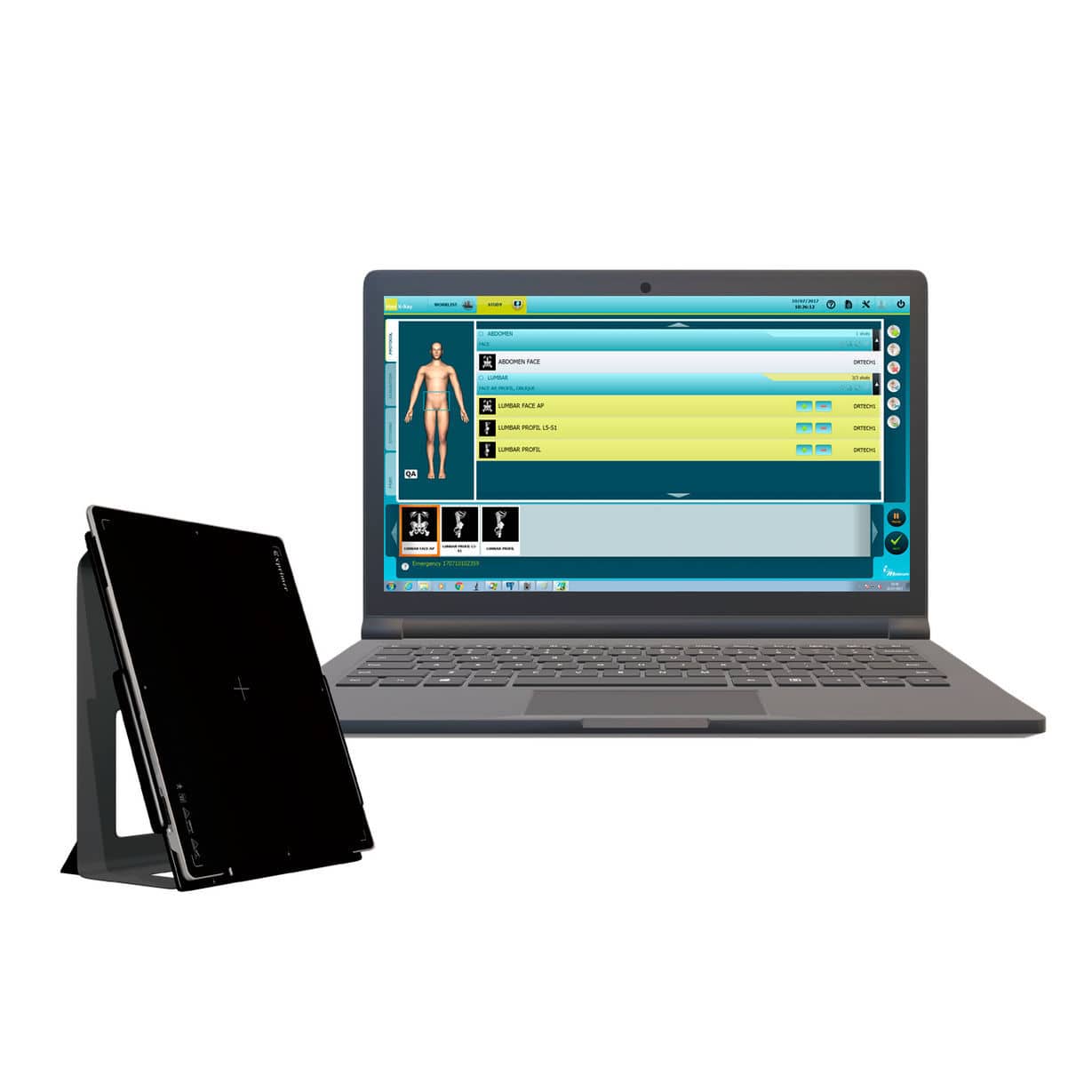 Safecom Radiography Radiography acquisition system - Medecom