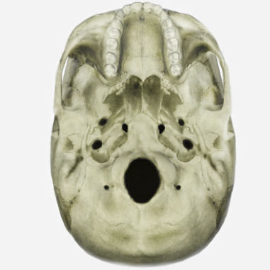 Radiography simulation module - SIMTICS - anatomy / with intracranial ...