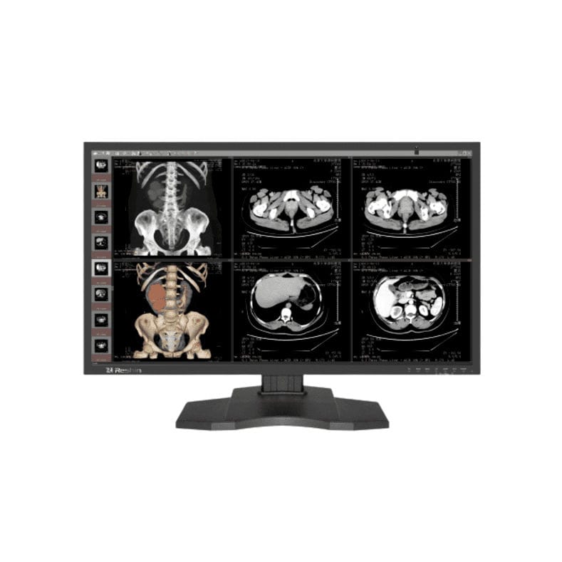 Medical imaging display MD85CA Reshin Monitors diagnostic / 31