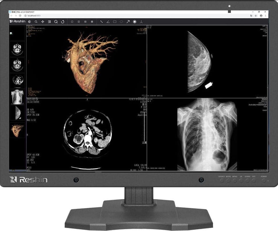 Diagnostic display MD120C Reshin Monitors radiology / mammography