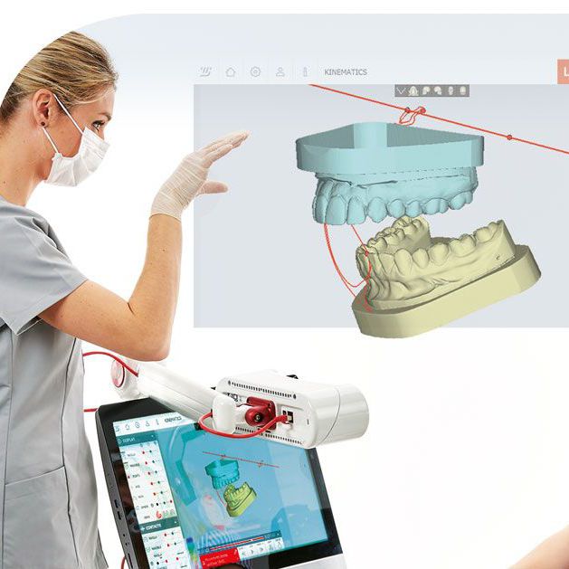 Dental software Modjaw SAS analysis / 3D viewing / diagnostic
