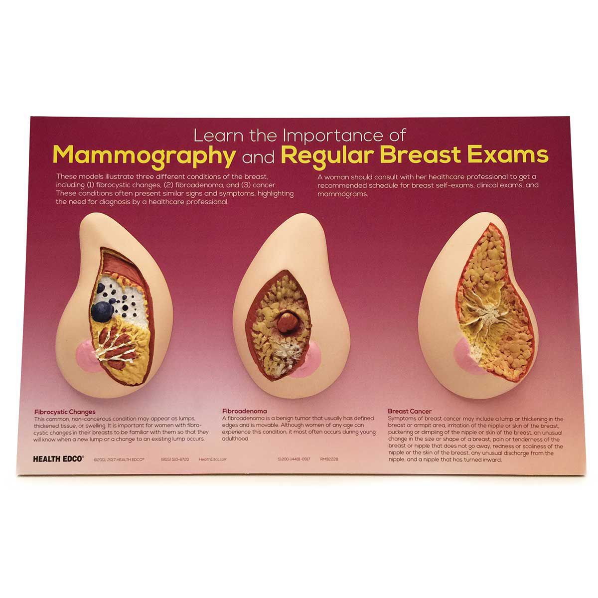 Breast model 51200 Health Edco for teaching