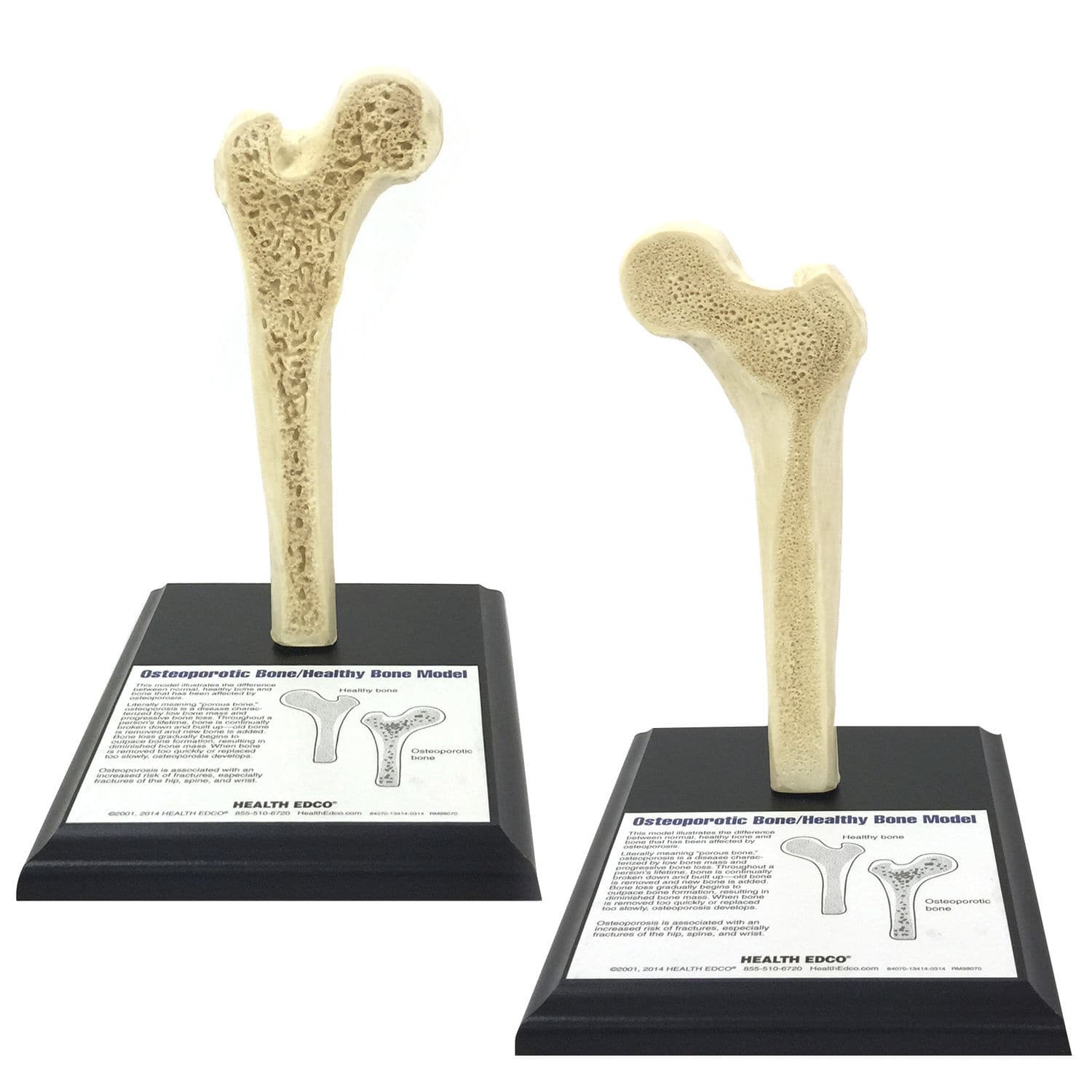Bone model - 84070 - Health Edco & Childbirth Graphics - osteoporosis