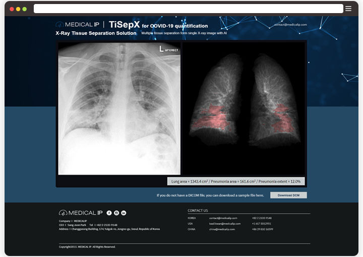 Radiology software TiSepX MEDICALIP Co., Ltd. analysis