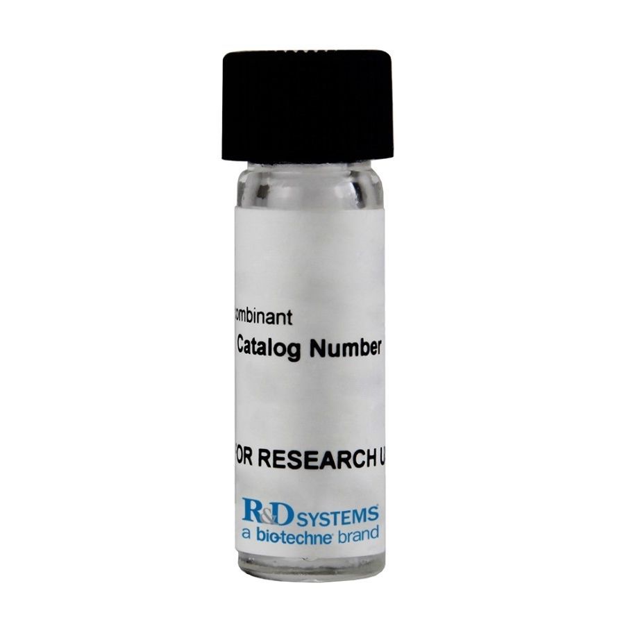 Protein Reagent U 100H R D Systems Enzyme Solution Bovine what-does-cf-stand-for-in-soccer-position-explained