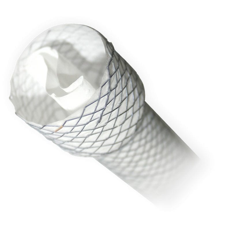 Esophageal stent - BRAVO - MITRA Industries - metal