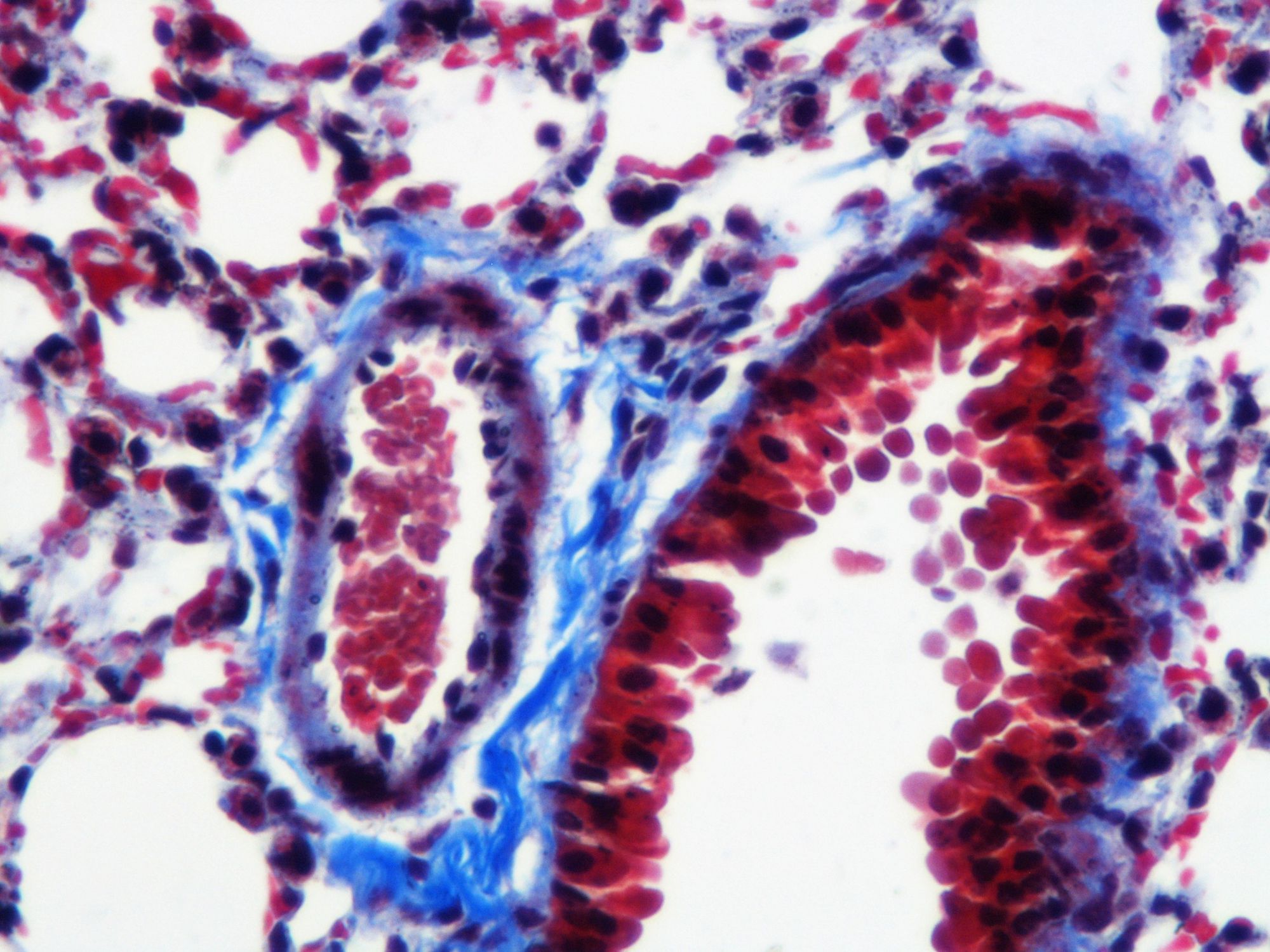 Masson’s trichrome reagent kit KH07007 Bioquochem for histology