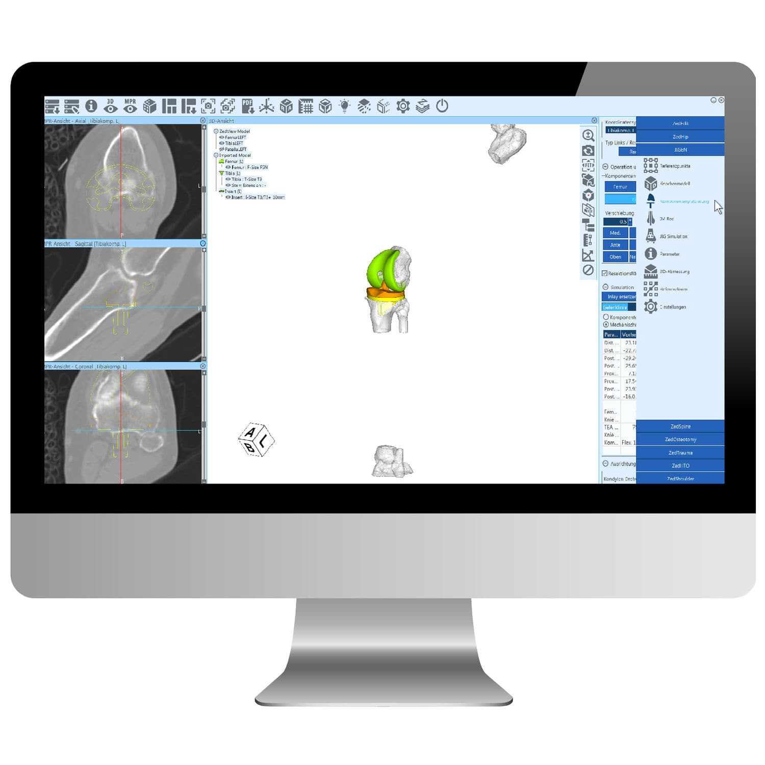 Planning software - ZedView - LEXI Co. - hospital / CT / for knee surgery
