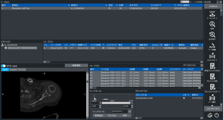 Visual Graphics Ct Software Medical software - ZedView - LEXI Co. - CT / for shoulder surgery / viewer