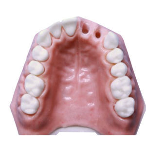 Maxilla anatomical model - DM – 112 - Selmodels SL