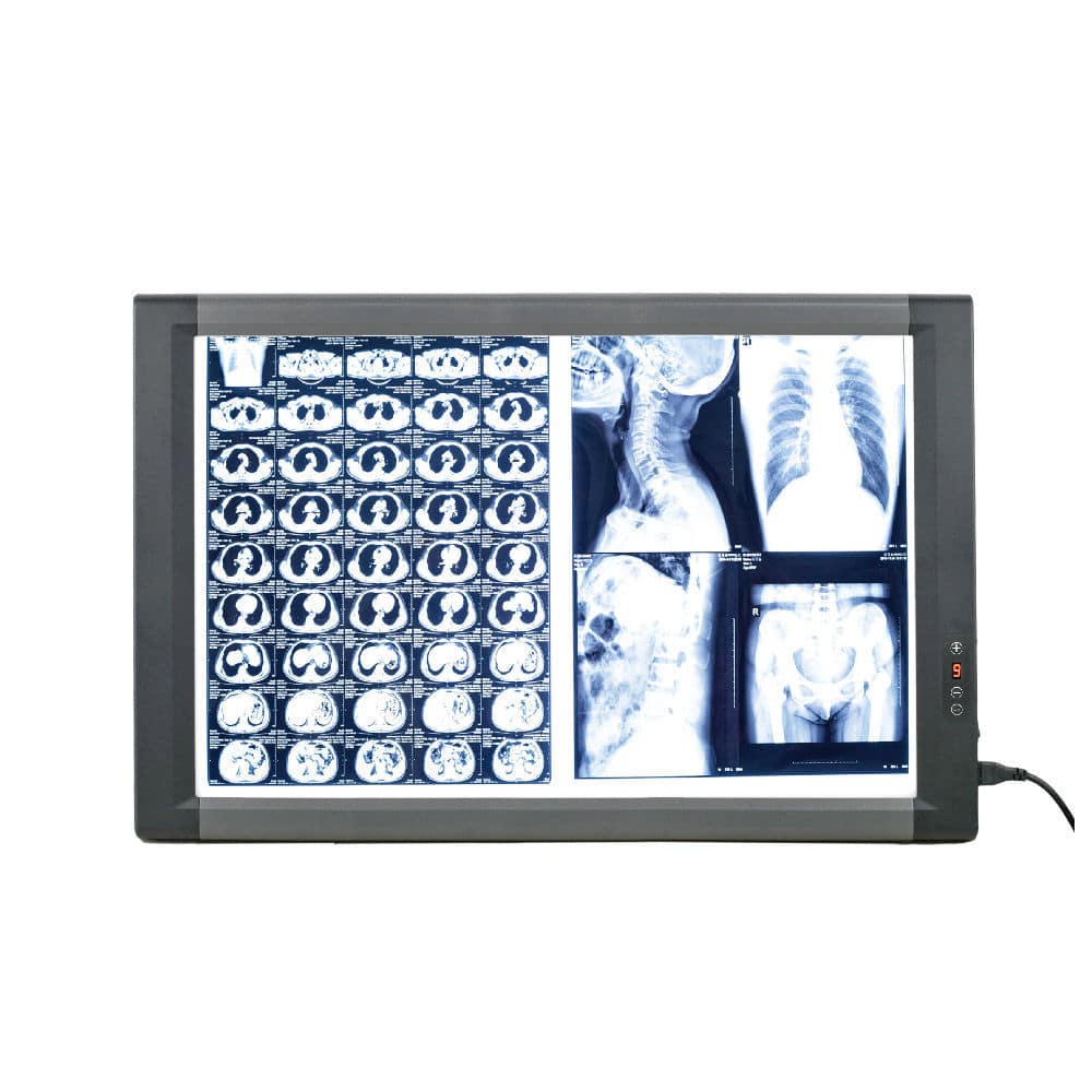 Digital Xray film viewer MG02 Nanchang Micare Medical Equipment