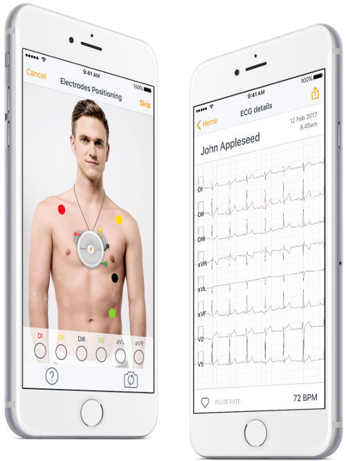 Iphone 12 online ecg