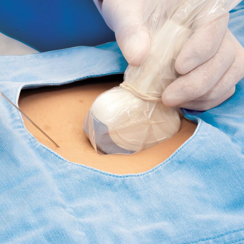 Ultrasound probe protective cover DUC8 series Fairmont Medical