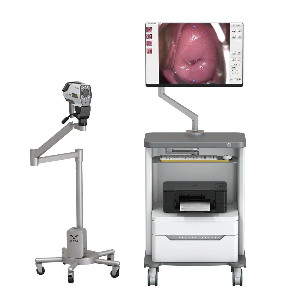 Video colposcope - YKD-3001 - AKX - trolley-mounted