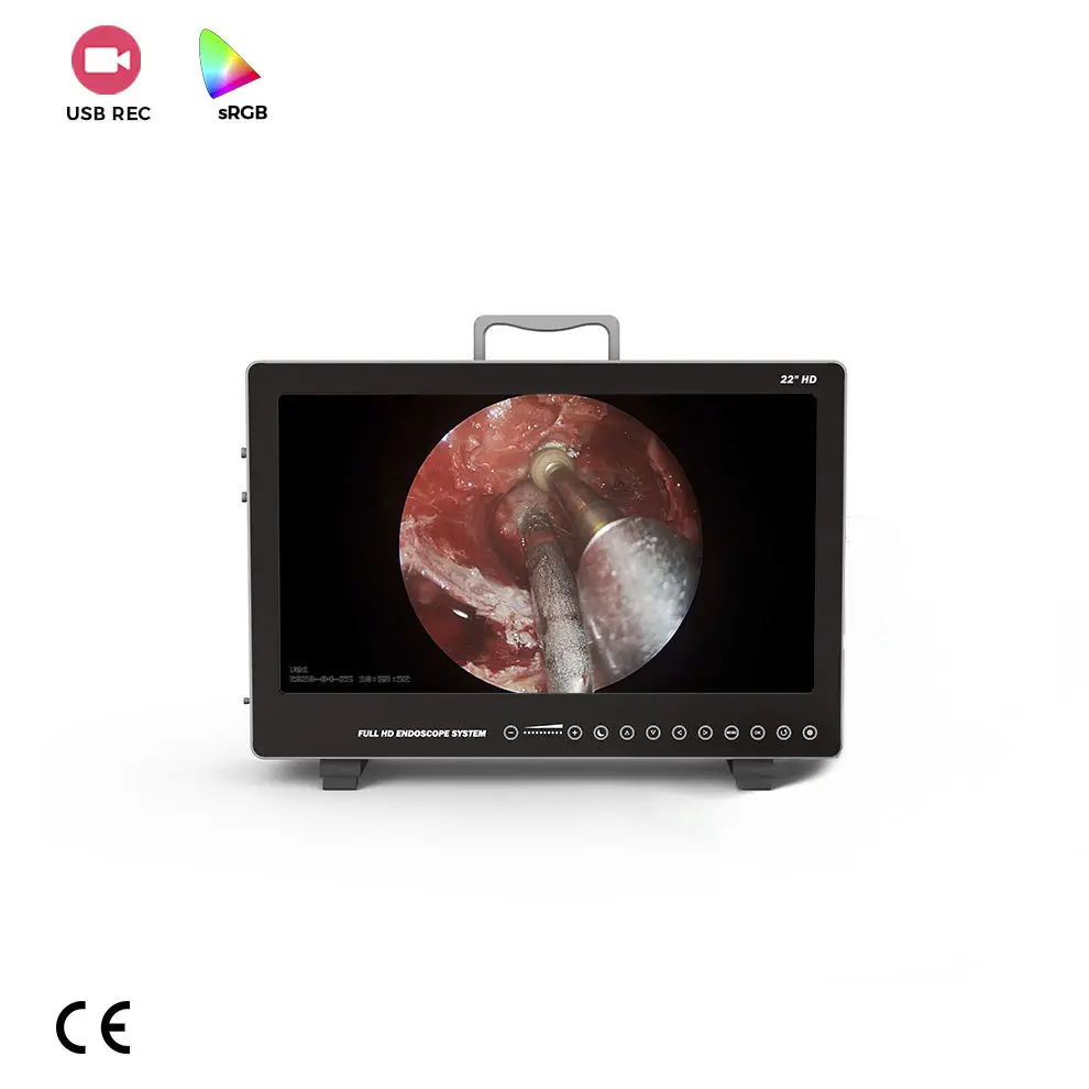 Endoscope camera - YKD-9122 - AKX - medical / surgical / digital