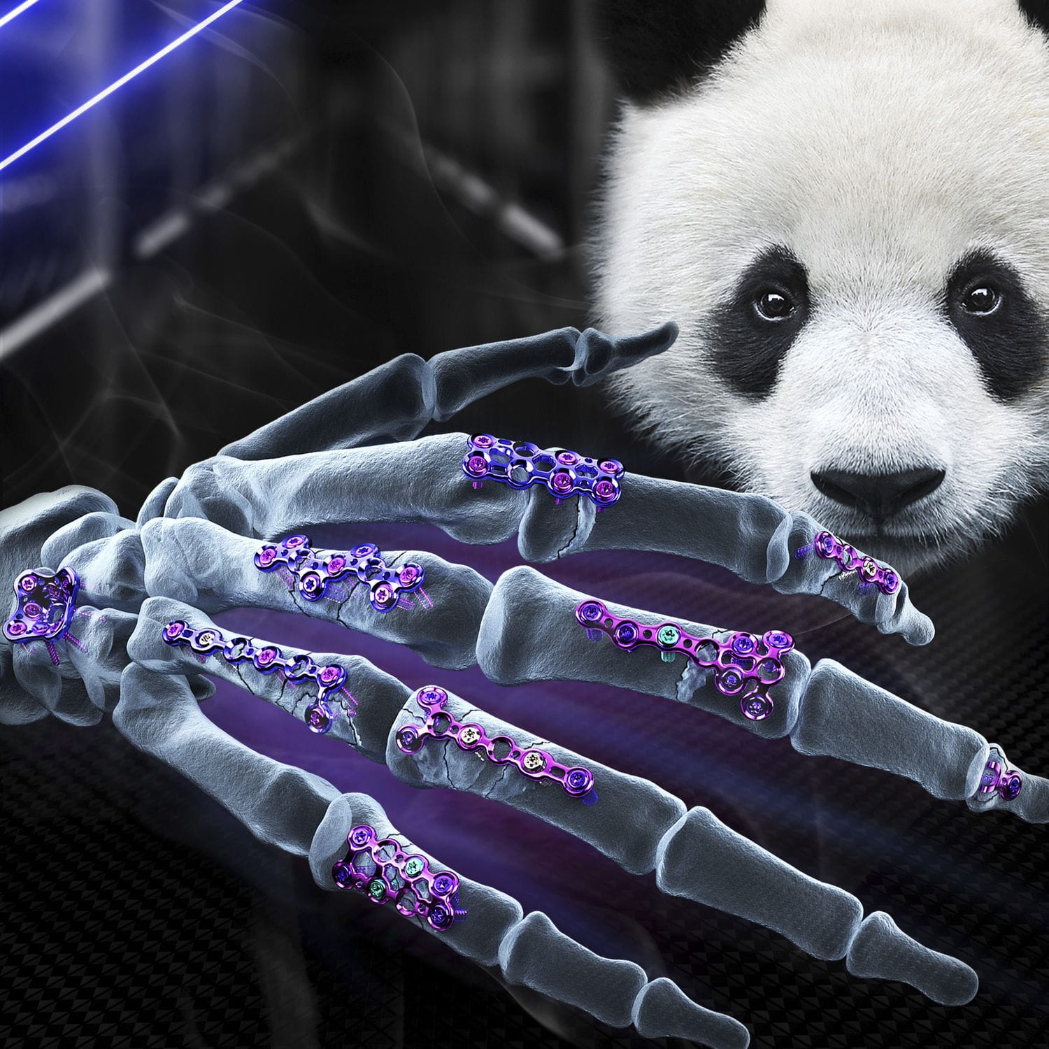 Hand phalange compression plate - PANDA - AGOMED Medizin-Technik ...