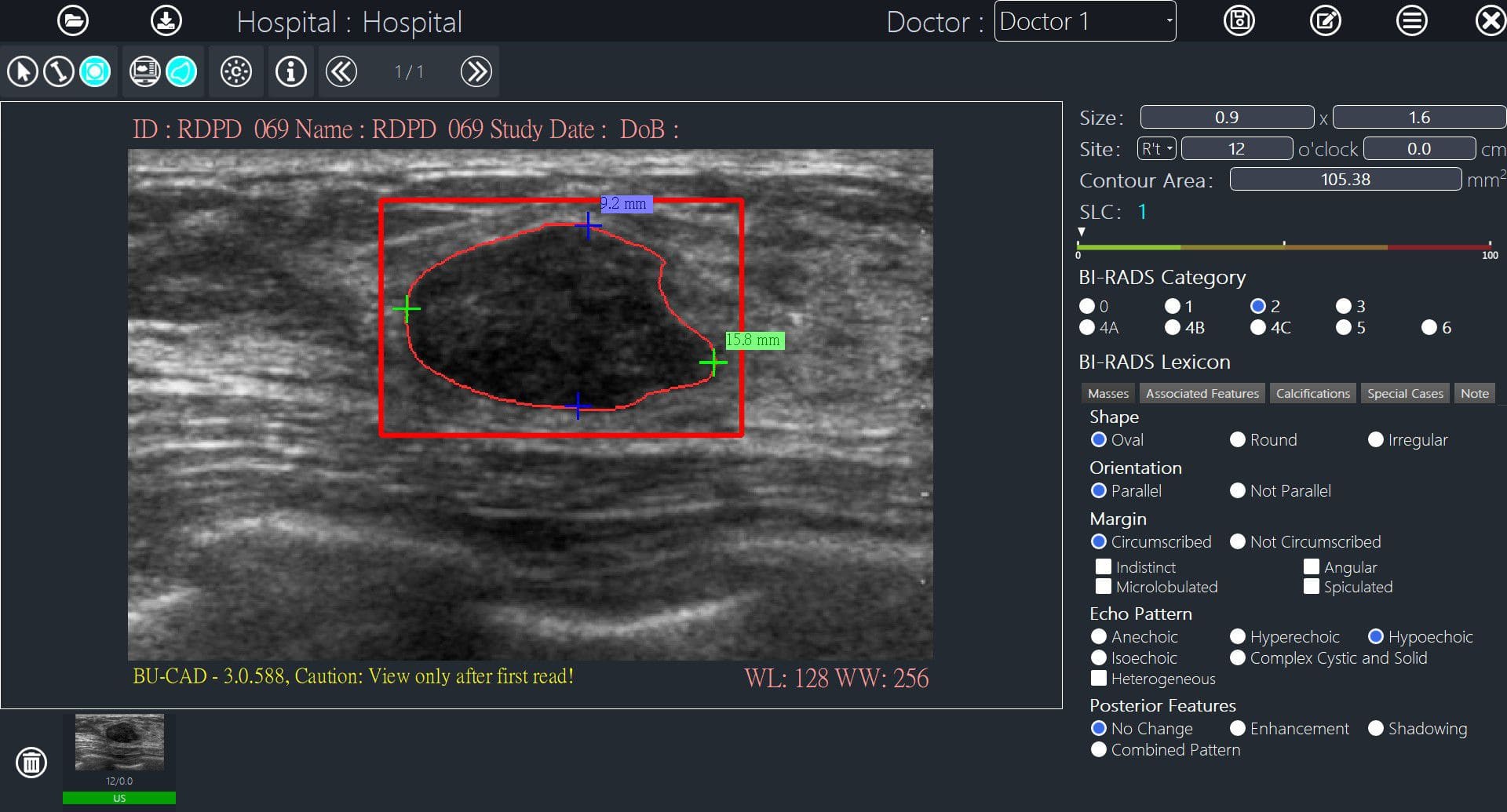 Ultrasound imaging software BUCAD™ TaiHao Medical image analysis
