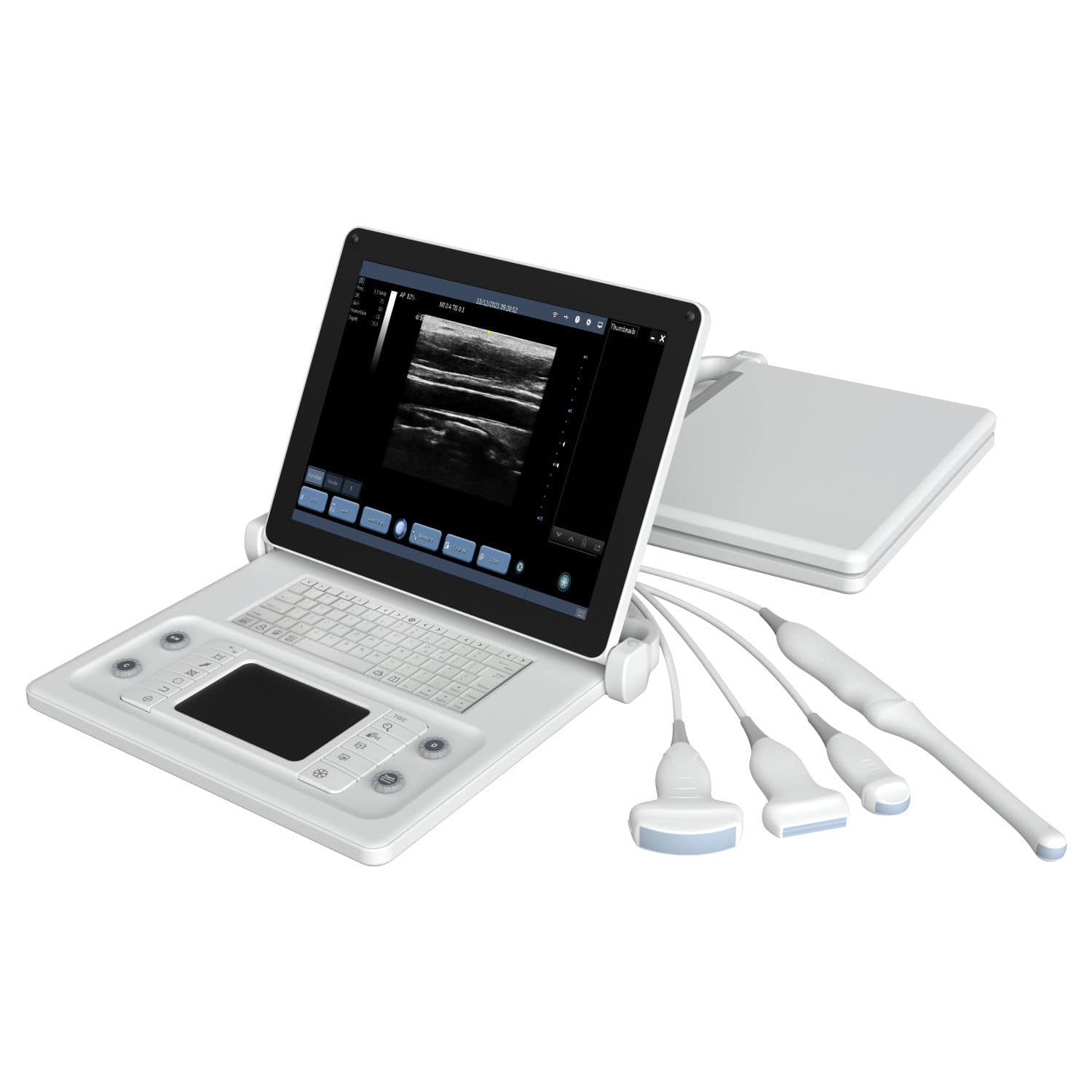 Portable ultrasound system F6 Wuhan Youkey BioMedical Electronics for multipurpose