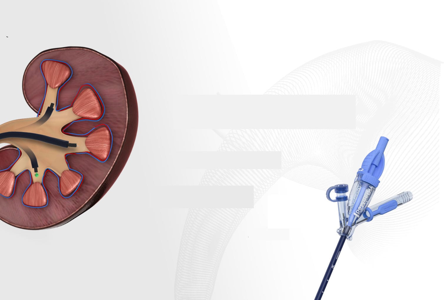 Uretra jinsiy aloqa kateteri