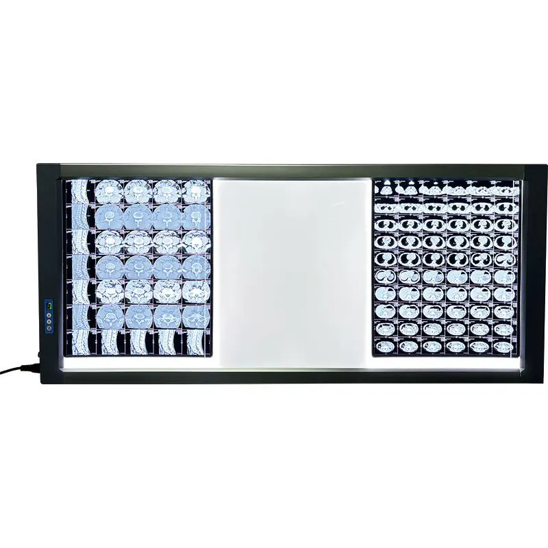 Digital X-ray film viewer - MST-4000III - Shantou Easywell