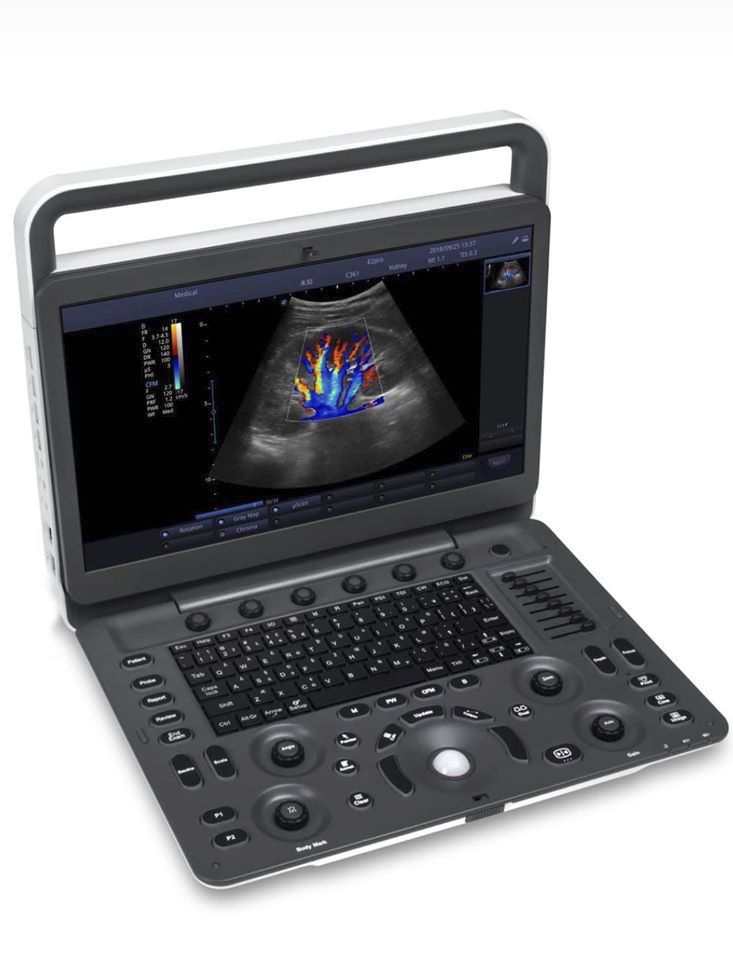 Portable Ultrasound System E1 Exp Beijing Itrason Technologies