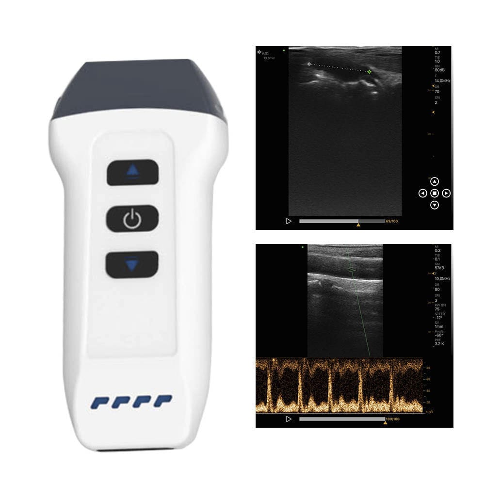 Hand Held Ultrasound System DW L2 DAEWI MEDICAL For Anesthetic And Intensive Care