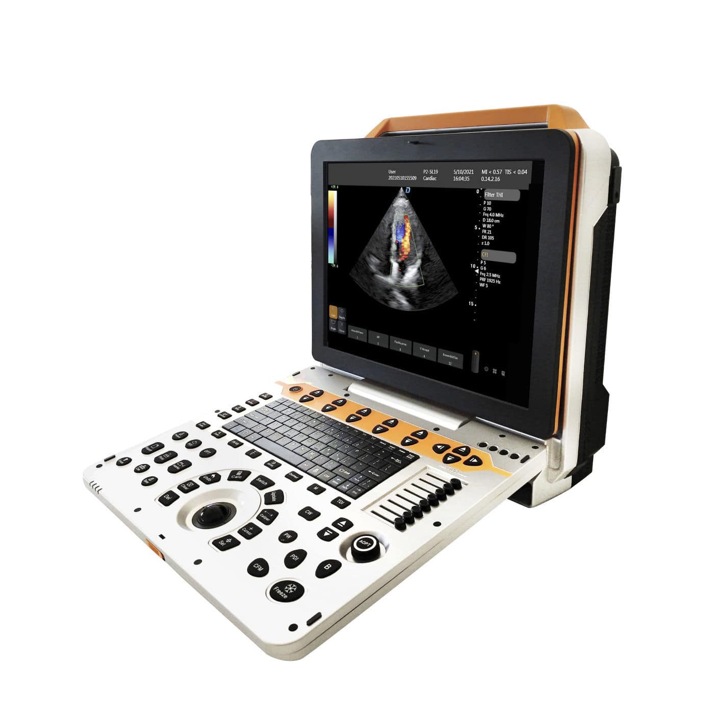Musculoskeletal ultrasound imaging system - DW-P60 - Dawei Medical