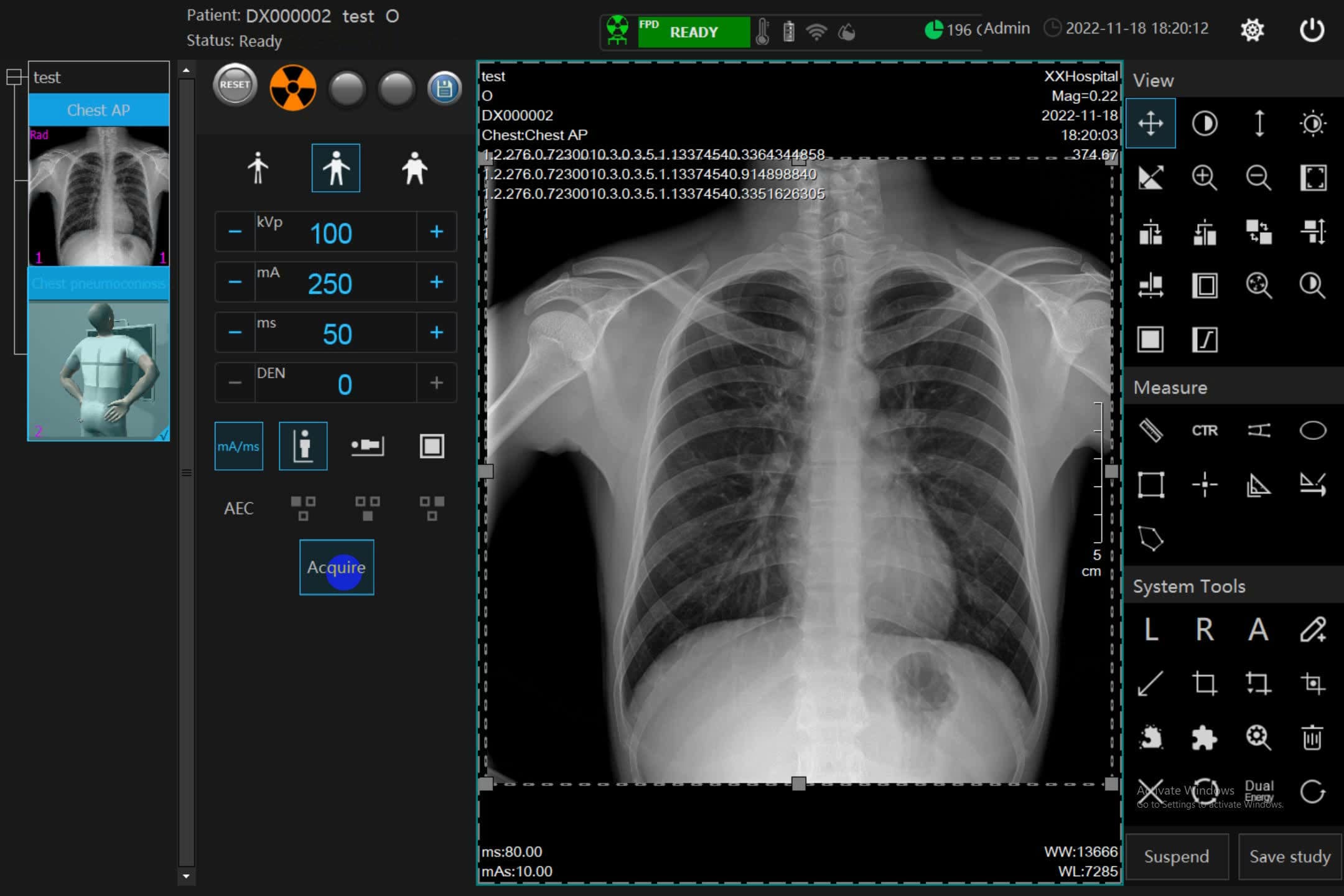 Medical software - GI100 - Suzhou Genray Technology - medical imaging ...