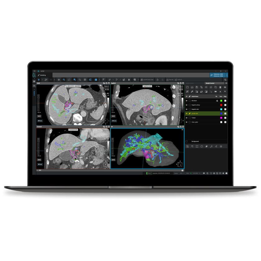 Visual Graphics Ct Software Medical software - Coreline - CT / data management / viewer