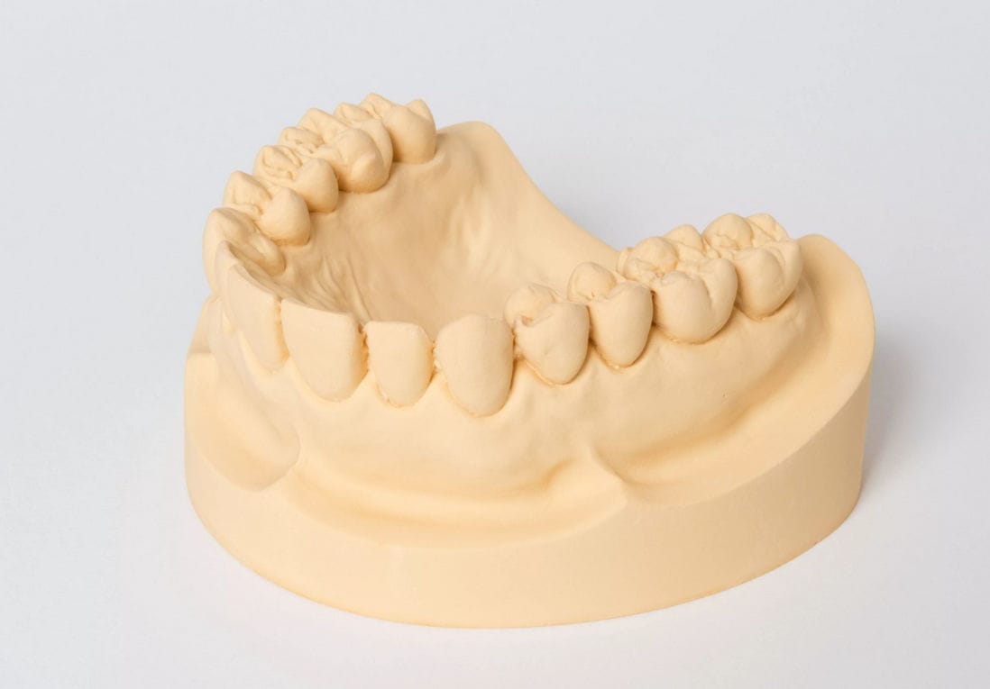 Plaster dental material Vantago Dentona AG modeling
