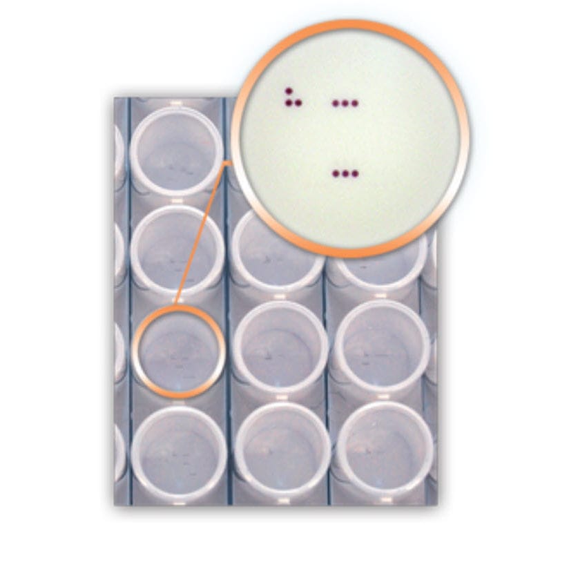 Pvd Testing Kit Infectious disease test kit - DA4270 - AID , Autoimmun Diagnostika ...