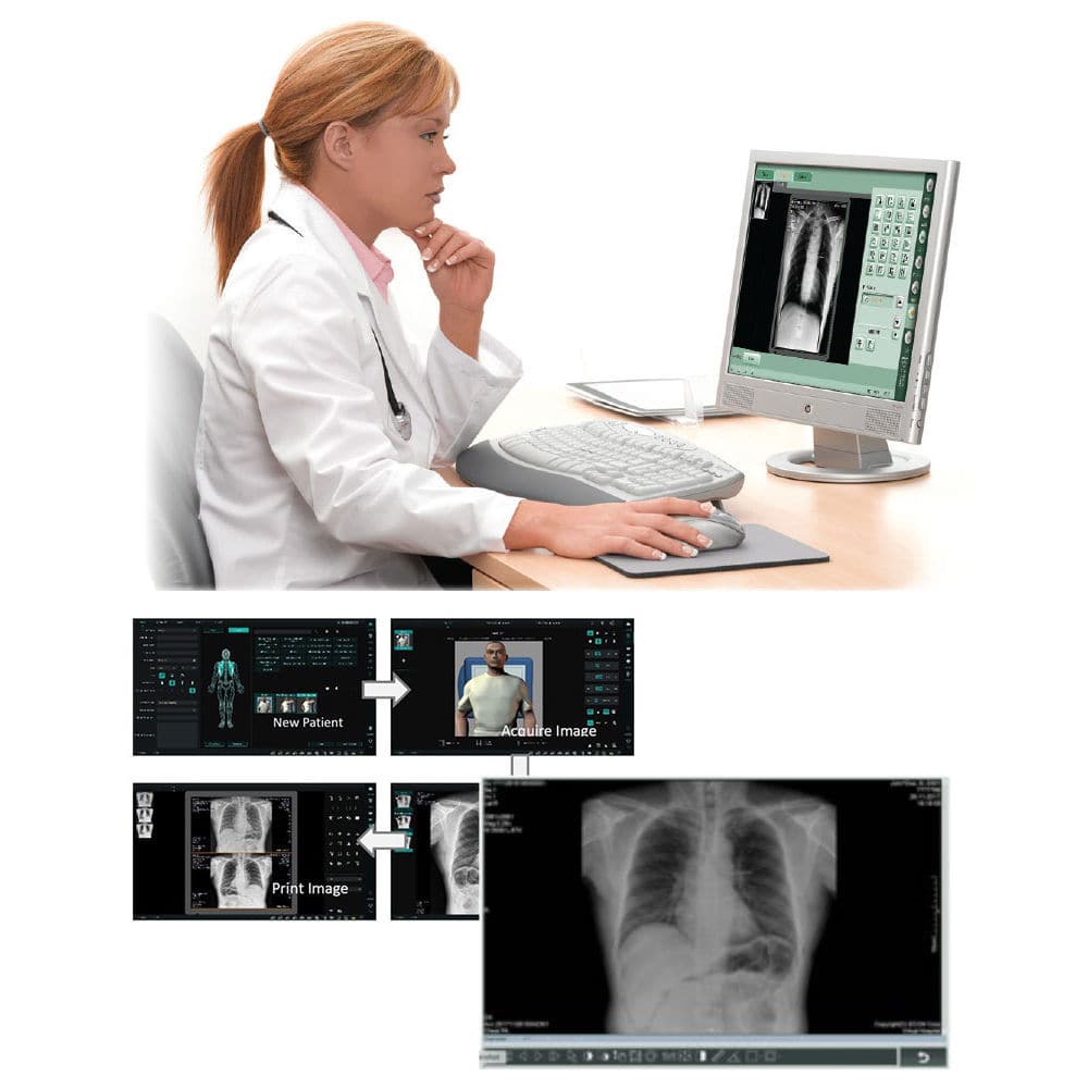 Retro Radiologist Computer Radiography acquisition system - Retro Print Pro - Codonics