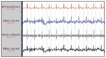Medical software - ECG Free - Compumedics - electrocardiography