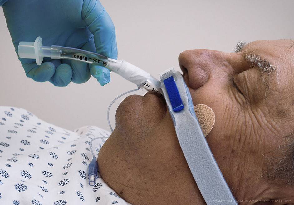 Endotracheal tube catheter fixation BreezeLock® Dale Medical